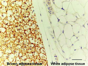 Brown and white adipose tissue.